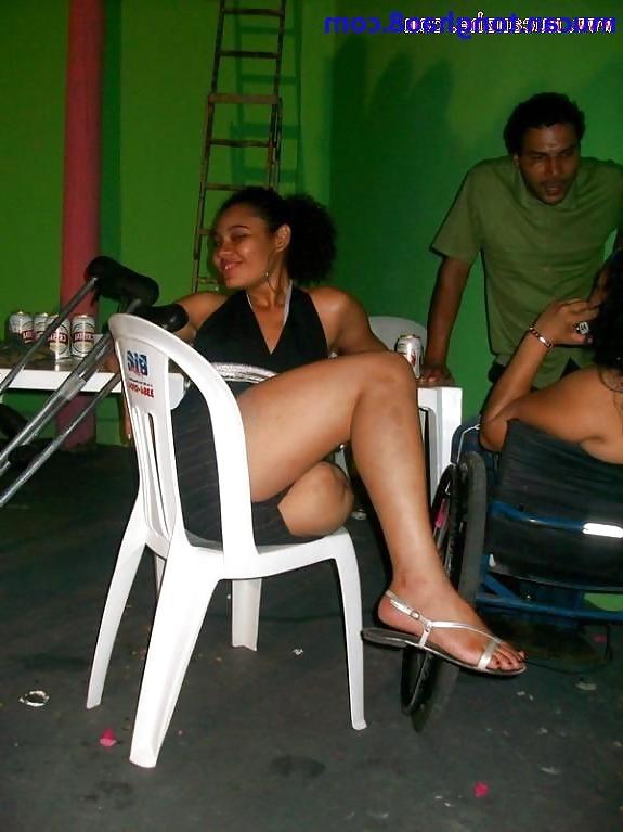 25P Amputee girls can be still sexy