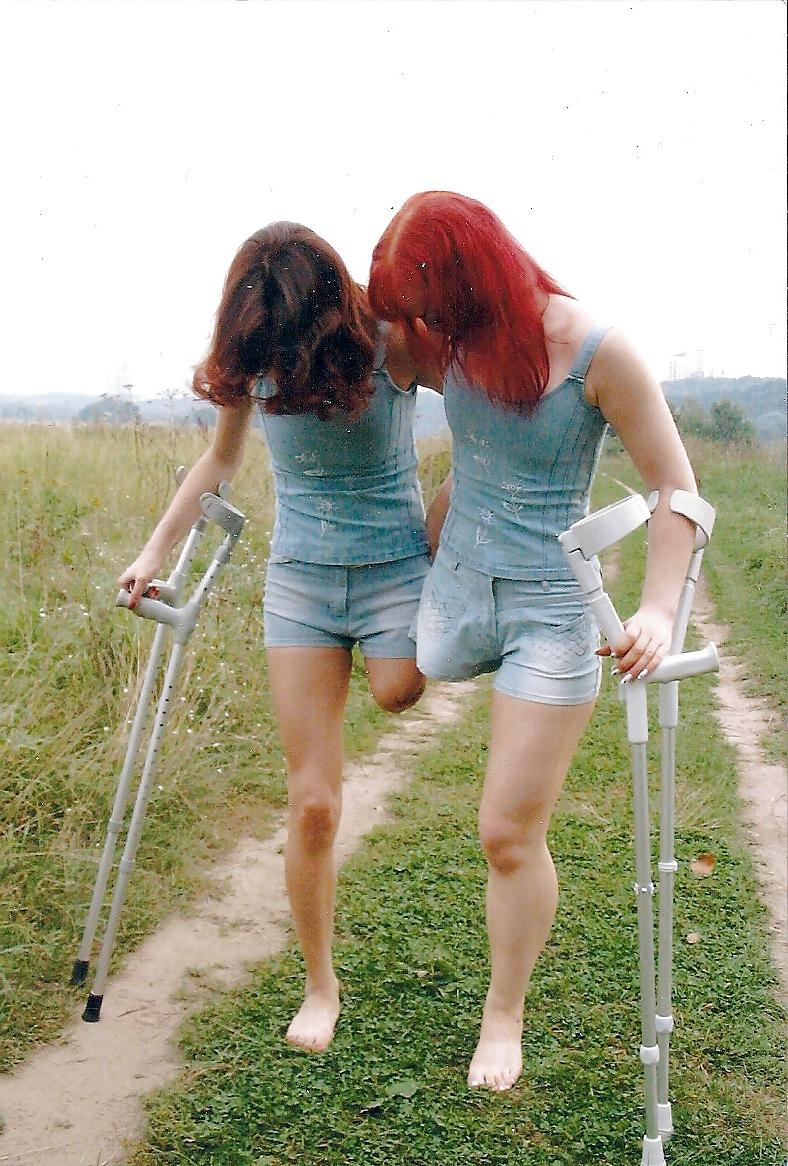 25P Amputee girls can be still sexy