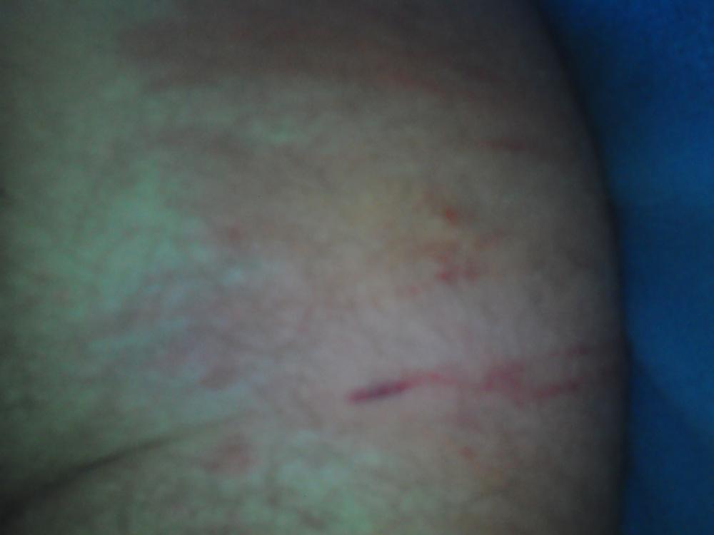 7P Sadistis Miss and Boy A