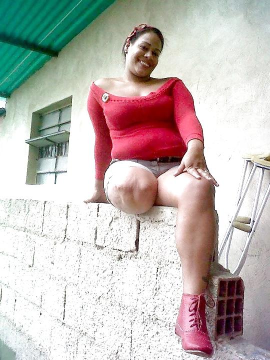 22P Amputee girls are so sexy
