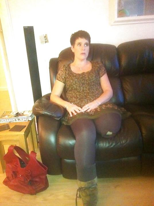 22P Amputee girls are so sexy