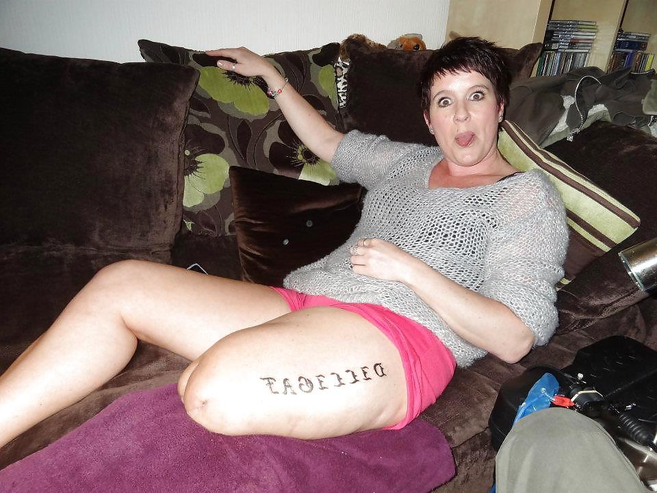 22P Amputee girls are so sexy