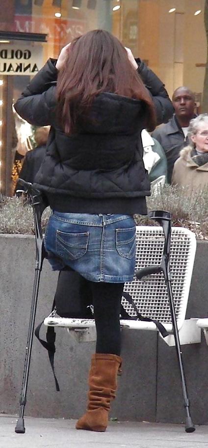 22P Amputee girls are so sexy