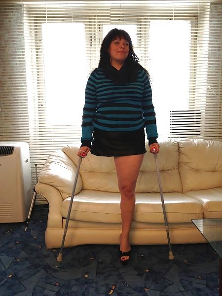 22P Amputee girls are so sexy