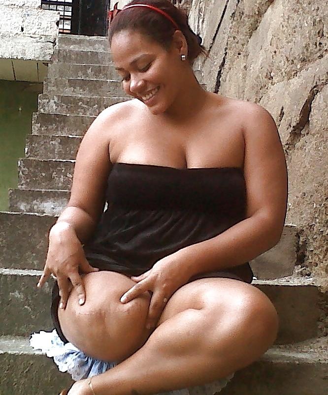 22P Amputee girls are so sexy