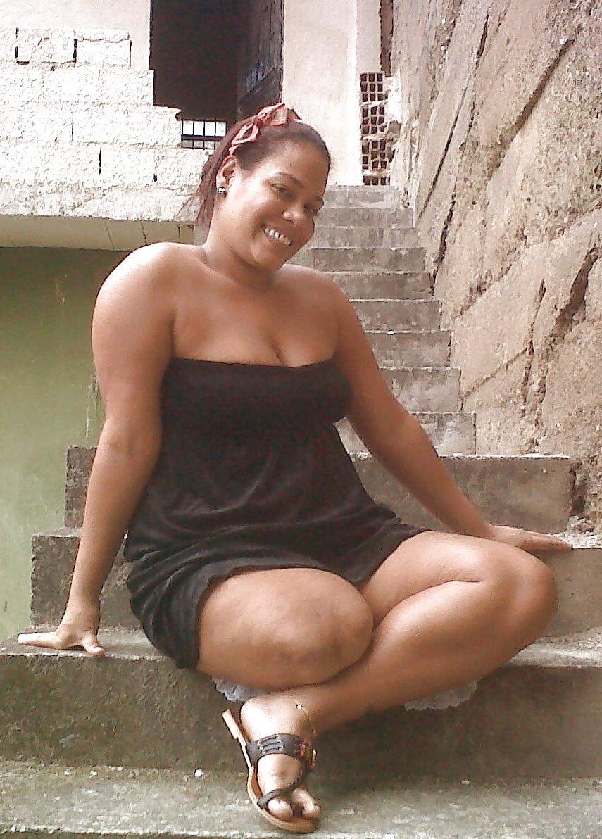 22P Amputee girls are so sexy