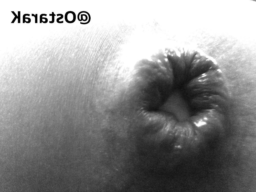 25P Anal insertions