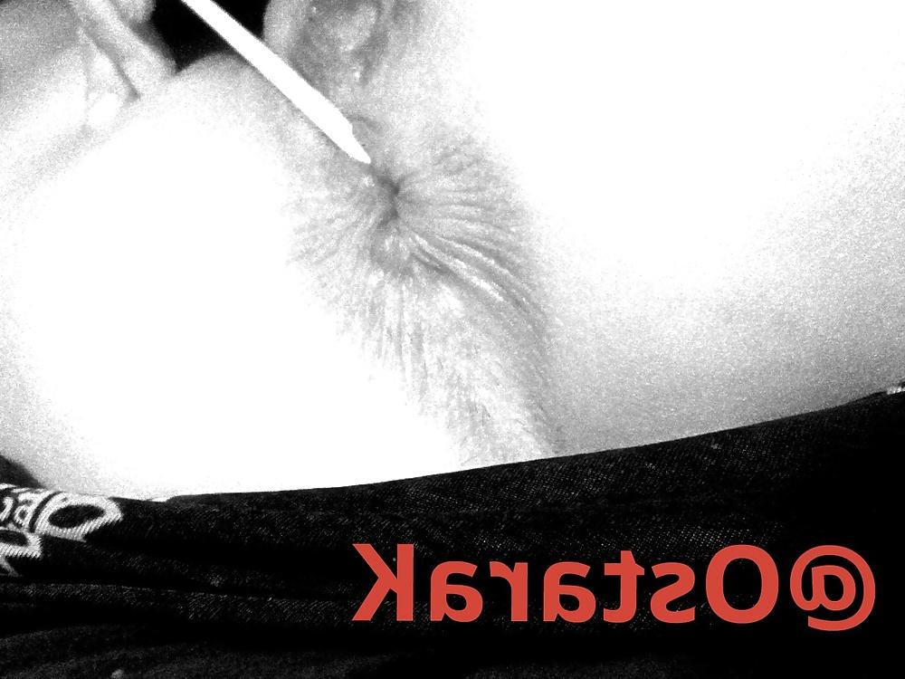 25P Anal insertions