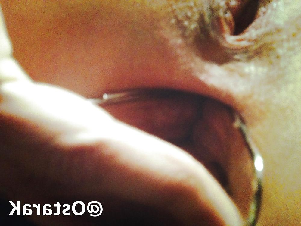 25P Anal insertions