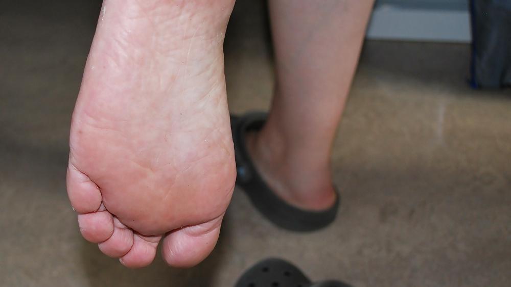 13P CLOSE UP FEET
