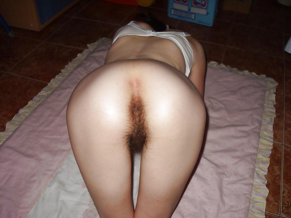 25P ANAL ANALE