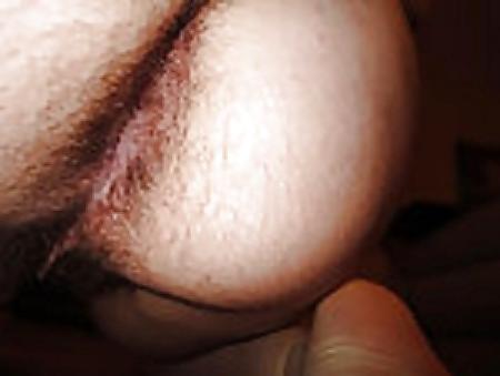 25P ANAL ANALE