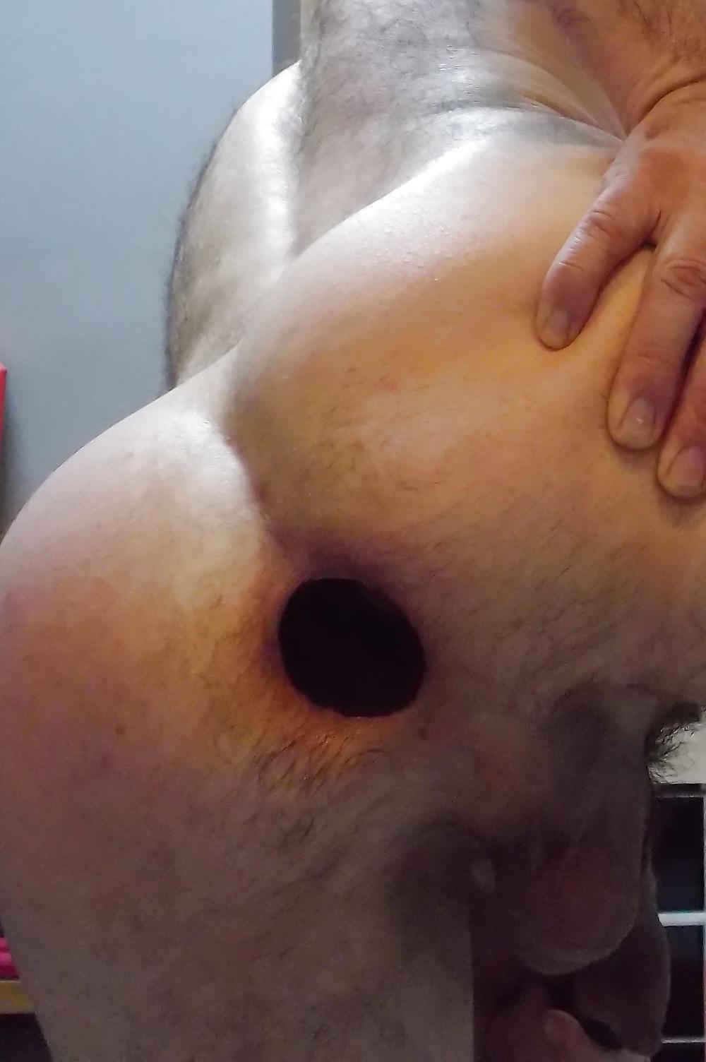 18P Anal gape and fist with a close up by Analisters