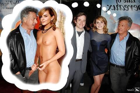 20P Emma Watson 9