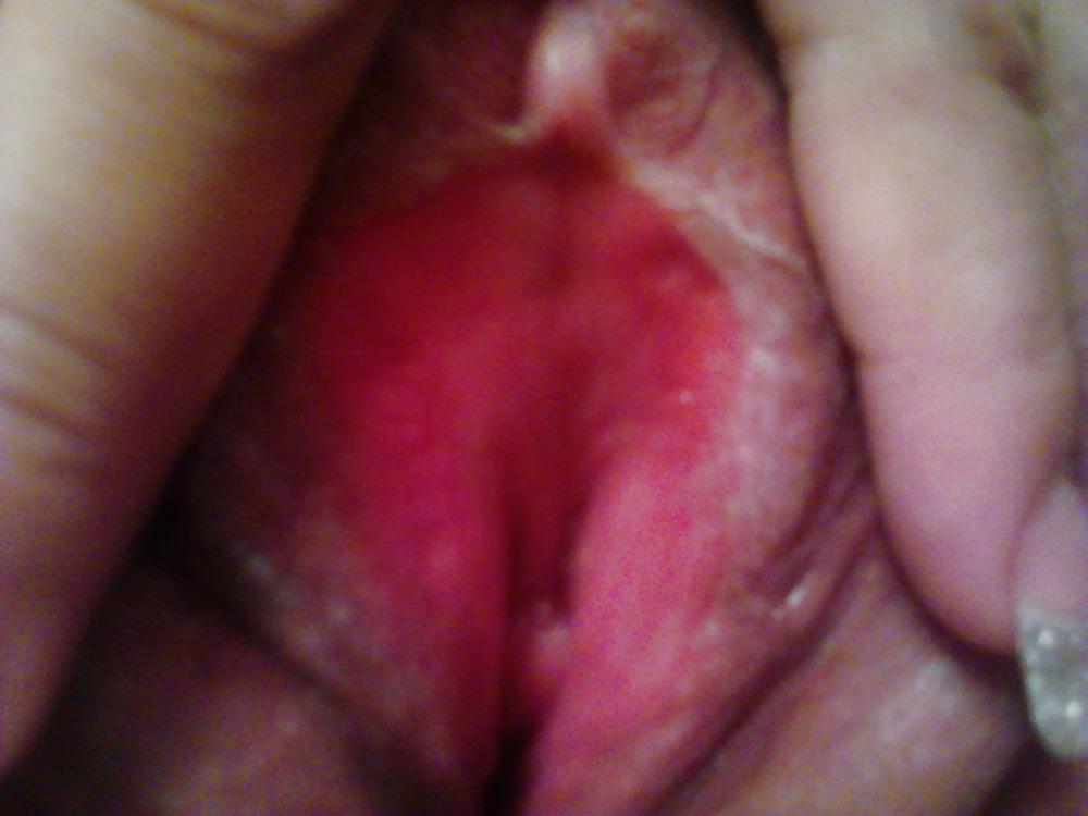 25P Selfshot stripper
