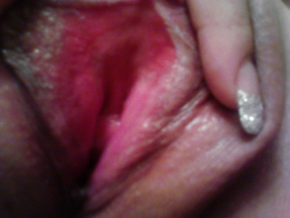 25P Selfshot stripper