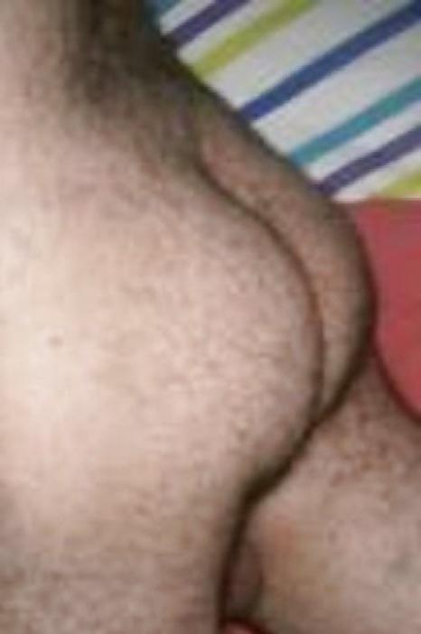 25P ANAL