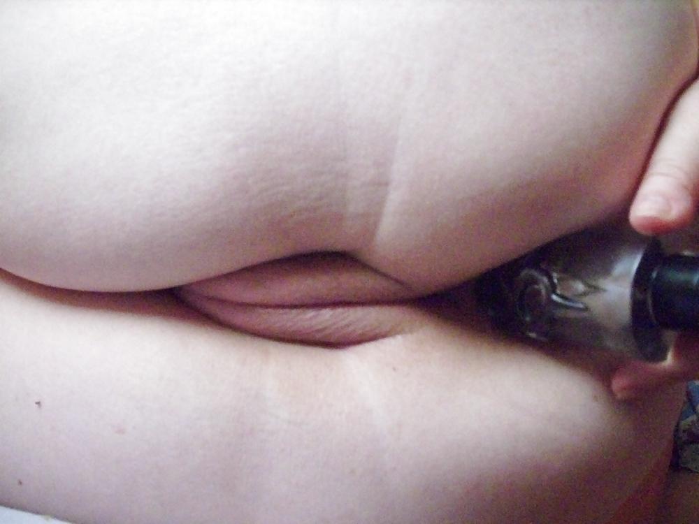 25P Anal