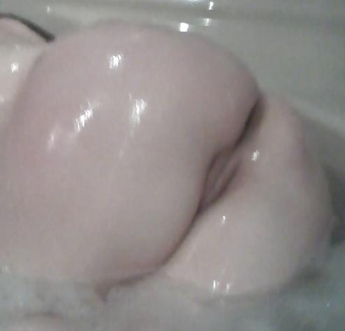 25P Anal