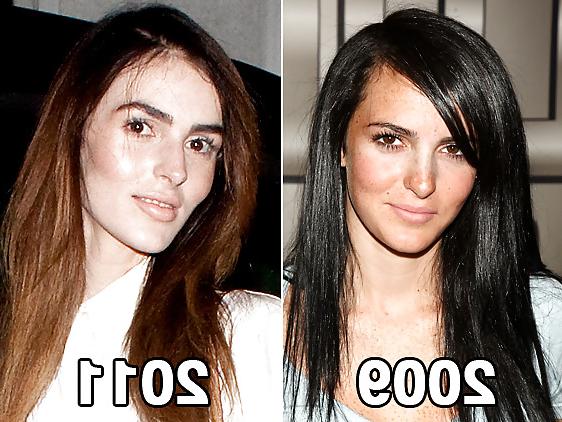 25P Ali Lohan collection