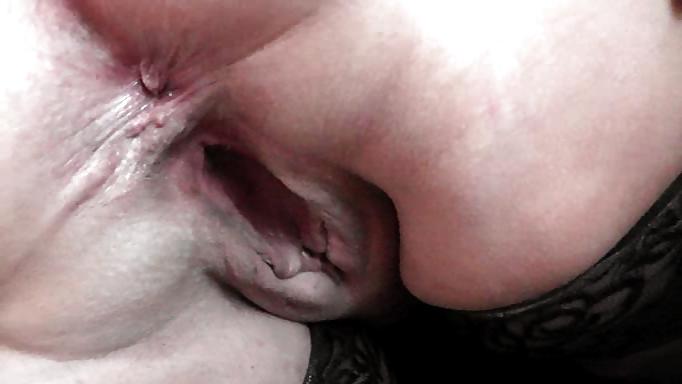 25P Anal Mix