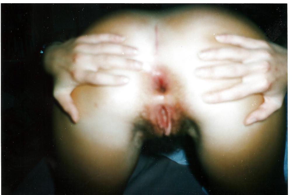 25P Anal Mix