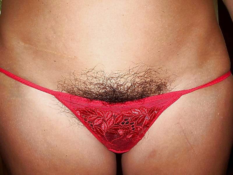 17P HAIRY STORY - II