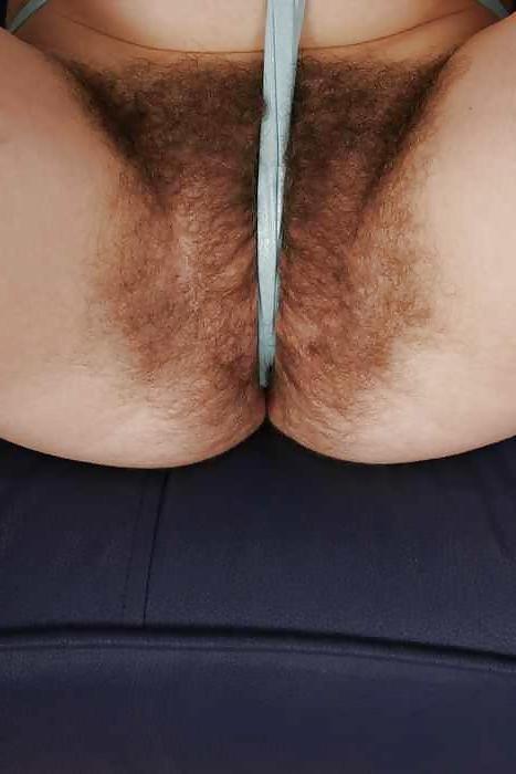 17P HAIRY STORY - II
