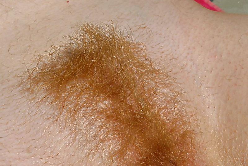 17P HAIRY STORY - II