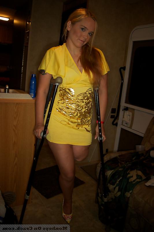 25P More sexy amputee girls