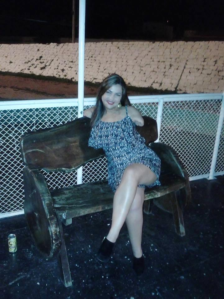 25P More sexy amputee girls