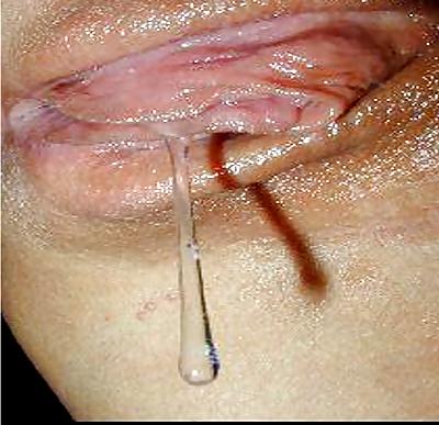 25P Wet dripping pussy