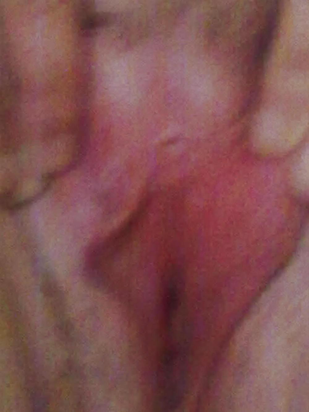 25P Some new pics 