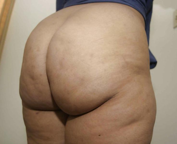 9P SOME BIG REDBONE HOOD BOOTY