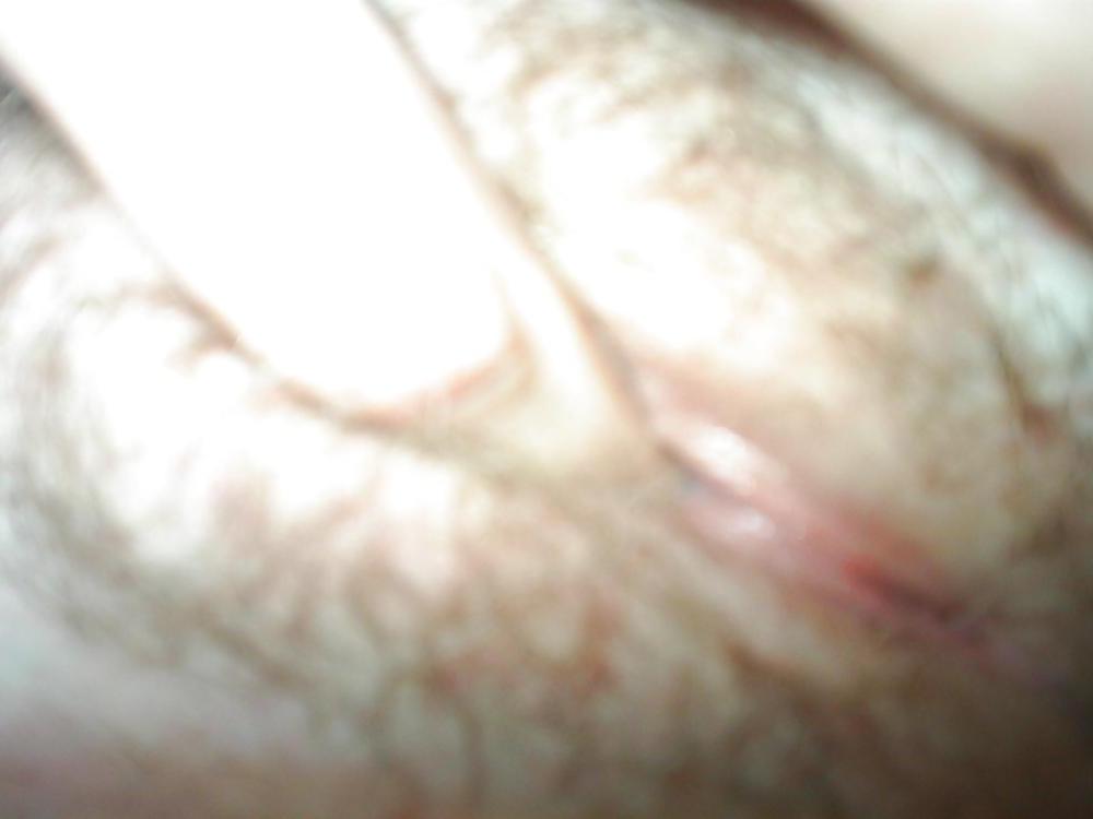 20P Pink pussy
