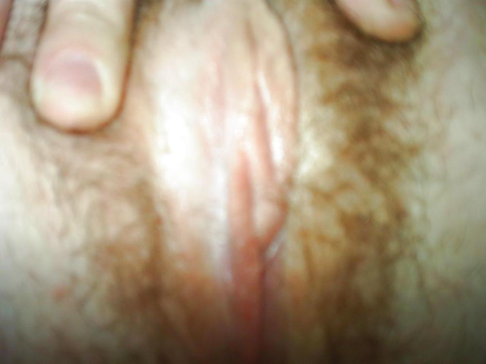 20P Pink pussy
