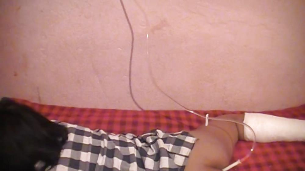 9P Enema #3