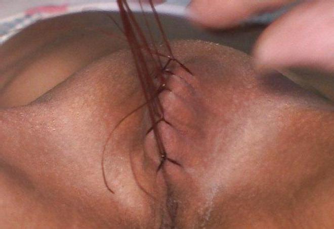 11P Sewn up pussy