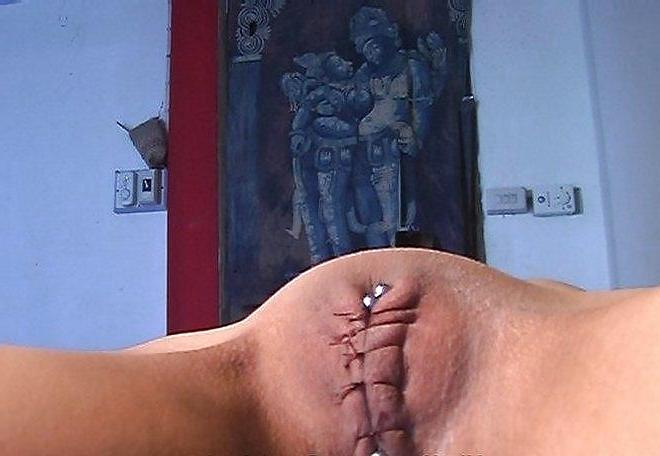 11P Sewn up pussy