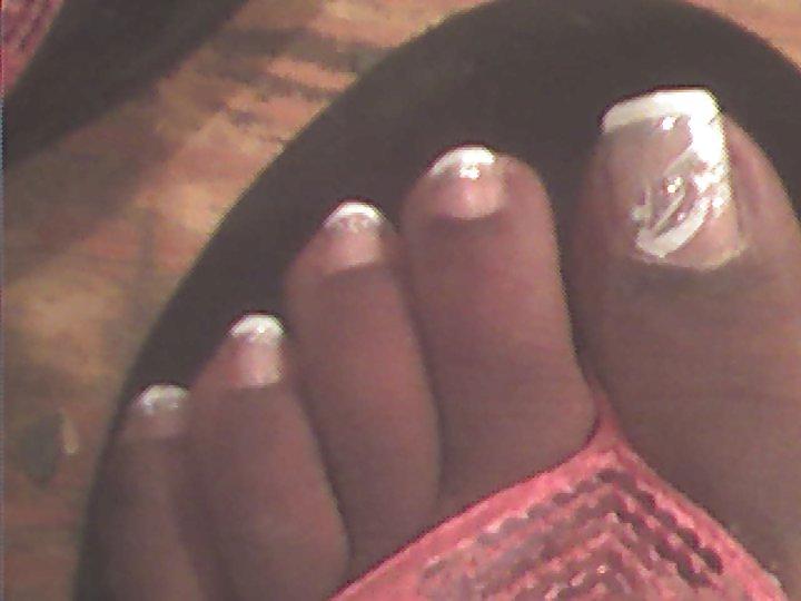 25P All toes and long toenails 
