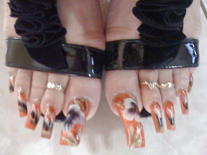 25P All toes and long toenails 