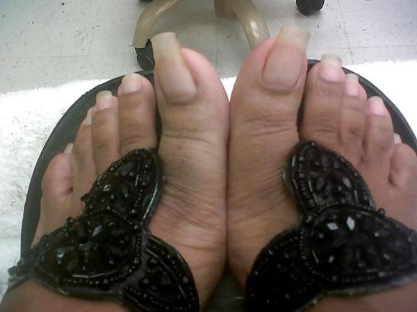 25P All toes and long toenails 