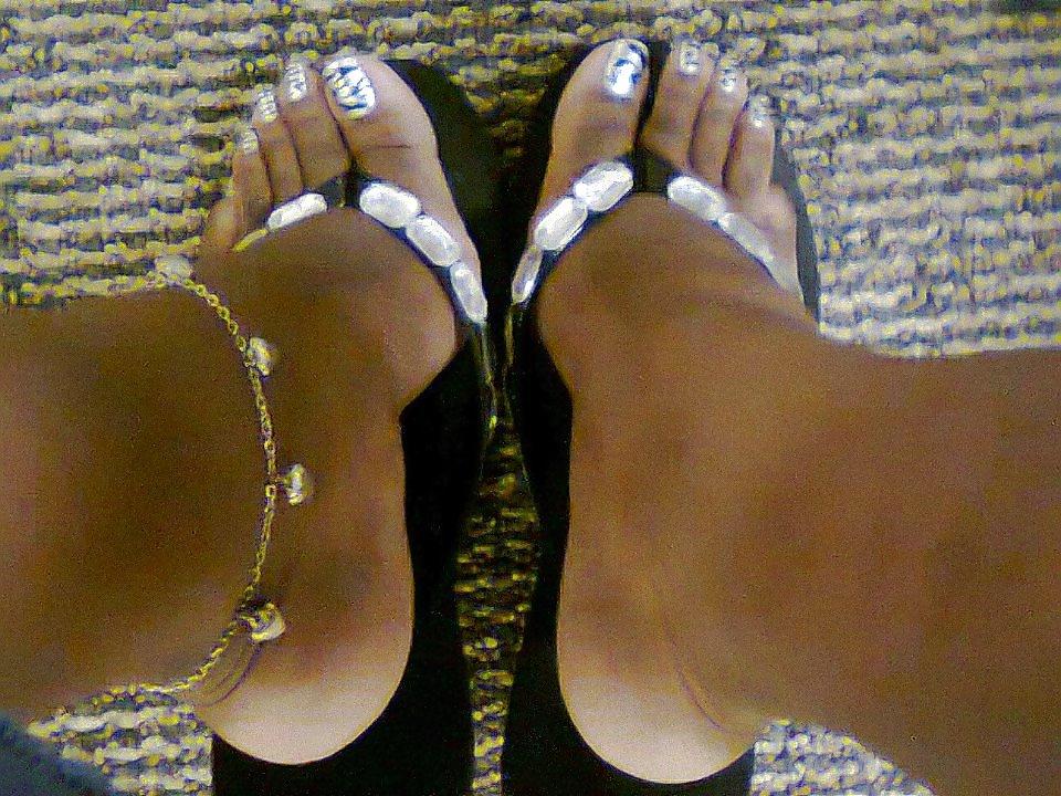 25P All toes and long toenails 