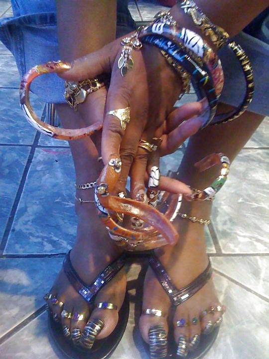 25P All toes and long toenails 