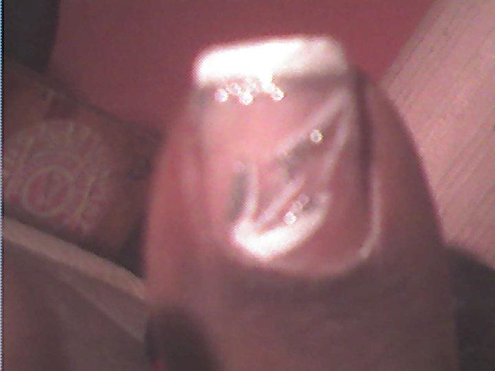 25P All toes and long toenails 