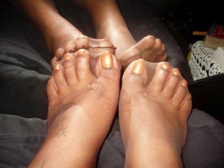 25P All toes and long toenails 
