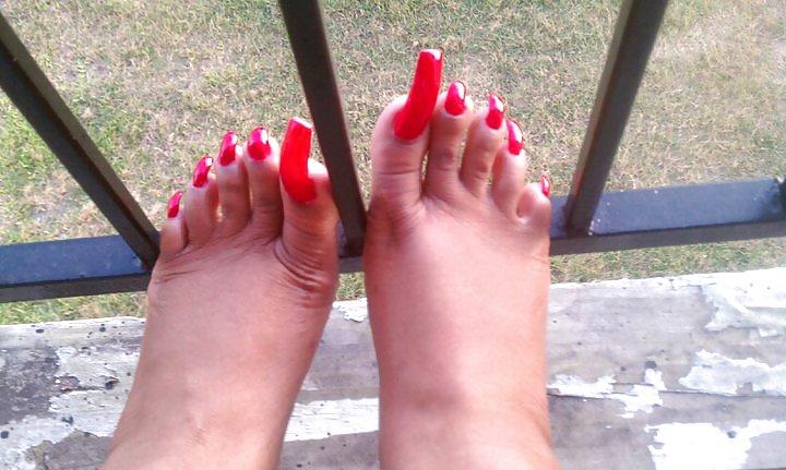 25P All toes and long toenails 