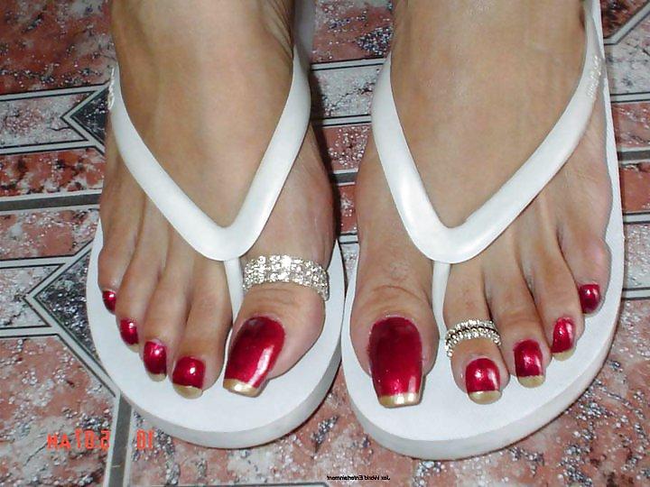 25P All toes and long toenails 