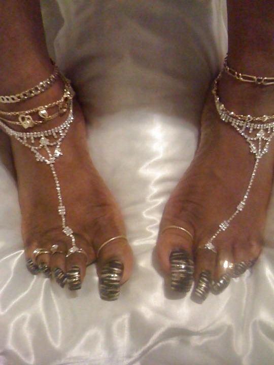 25P All toes and long toenails 