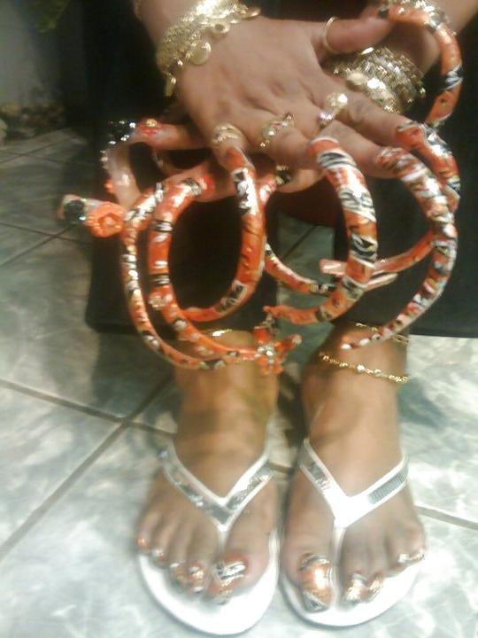 25P All toes and long toenails 